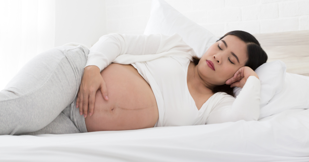 What Is Pregnancy Insomnia